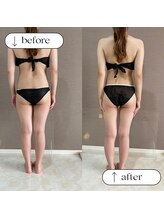 トータルビューティーサロンリア(Li'a)/ビフォー＆アフター