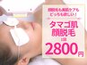 当月OK/【タマゴ肌顔脱毛】産毛撃退で毛穴レス☆ライトシャワーで作る水光肌
