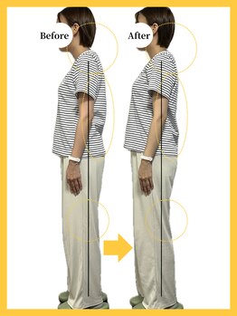 美容整体 レモン/姿勢矯正