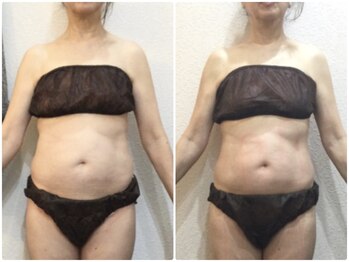 美容整体ウェリナ 名駅院/小顔矯正/骨盤矯正/美脚サロン