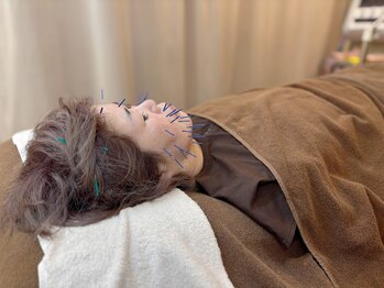 こじま 富雄団地接骨院/ヒト肝細胞美容鍼