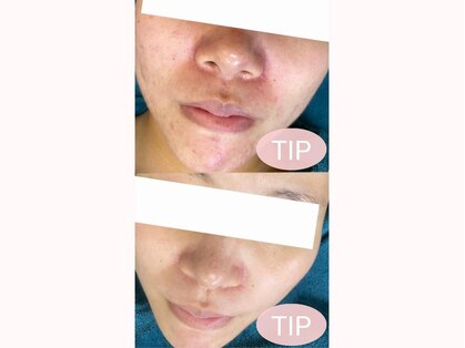 ラボーテエサンテ バイ ティアラ(la beaute et sante by Tiara)の写真