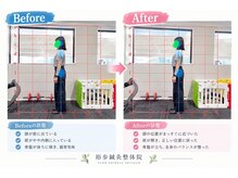 裕歩 吹田岸辺の雰囲気（全身矯正のビフォーアフターです！！）