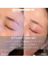 エレガ(ELEGA)/ハリウッドブロウリフト