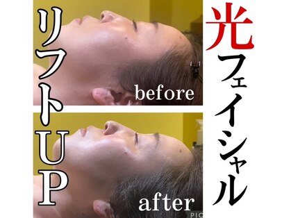 ルリアン(Le lien)の写真