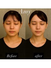 エイミー(Amy)/人気No.1［頭蓋骨矯正＋韓骨気］