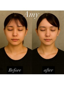 エイミー(Amy)/人気No.1［頭蓋骨矯正＋韓骨気］