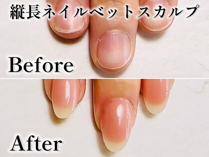 チヒロネイルの写真