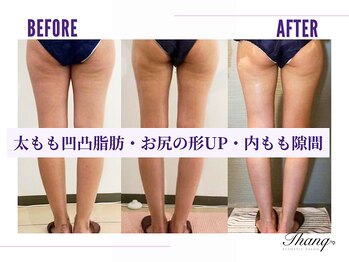 サンク(Thanq)/スマス痩身効果でエリア人気☆