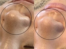 アンベリール(Embellir)/松ヤニワックス♪