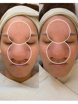 彌庵/タイムロックプログラム　症例