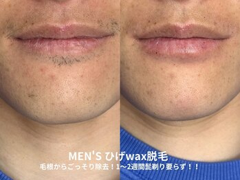 ピブ(pib.)/ツルツル清潔感UP！