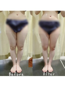 マイフェアレディ 今池(MyFairLady)/最強ラフォス痩身エステ