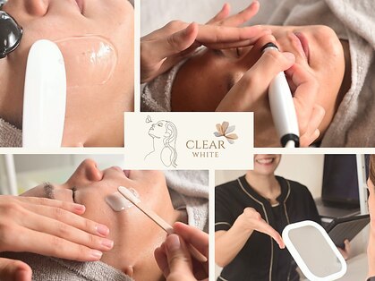 クリアホワイト(Clear White)の写真