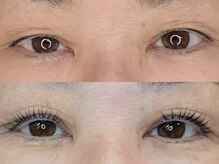 アイラブ(eye love)/