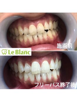 ルブラン 奈良店(Le Blanc)/【印象を変える】