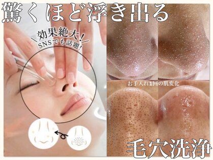 ルチル(Rutile)の写真