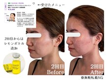 グロウズ(Glows)/