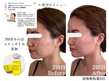 グロウズ(Glows)/