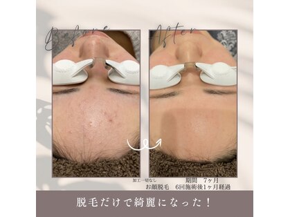 モア トゥインクル 倉敷店(MORE twinkle)の写真