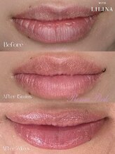 ウィズリリナ 新横浜(with Lilina.)/ローマピンク　リップ施術直後