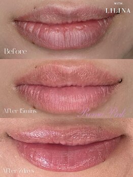 ウィズリリナ 新横浜(with Lilina.)/ローマピンク　リップ施術直後