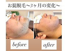 サロンドスパ(Salon de Spa)の雰囲気(サロン一番人気☆髭脱毛☆痛みを抑えつつ、しっかりと効果を実感)