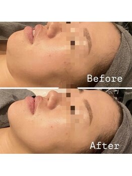 ラルミエール 緑店はなれ(la lumiere)/贅沢スペシャルコース