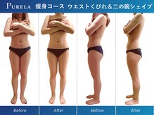 ピュアラ梅田/最強部分マシンInshape