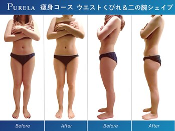 ピュアラ梅田/最強部分マシンInshape