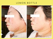 ハノハノ 八代店(HANO HANO)/【八代初導入！】レモンボトル☆