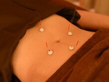 【鍼灸×よもぎ蒸し】 ハリ是好日【3月 NEWOPEN(予定)】