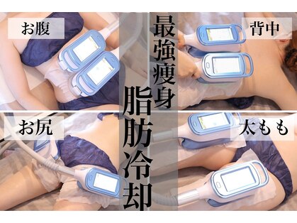 ビルーチェ(BELUCE)の写真