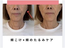 カラダミックス(karadamix)/頬こけの改善ケア