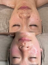 エユージュ(eyuge)/