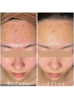 ラ ジェム(La gemme)/【ララピール】