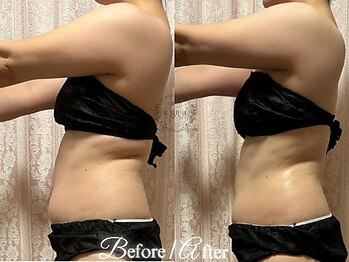 ラナンスパ(RANUN SPA)/気になるお腹もスッキリ美BODY
