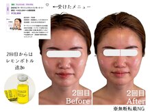 グロウズ(Glows)/