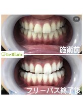 ルブラン 奈良店(Le Blanc)/毎日の笑顔をもっと素敵に♪