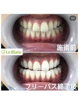 ルブラン 奈良店(Le Blanc)/毎日の笑顔をもっと素敵に♪