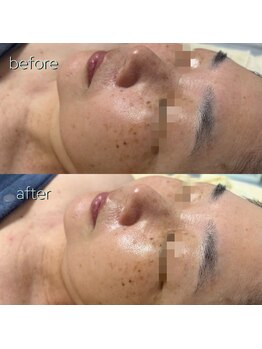 リボーン(be reborn)/初回の方