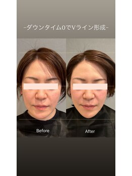 プライミー(PRIMY)/顎関節を改善