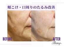 サンク(Thanq)/月に1度エステで肌管理を