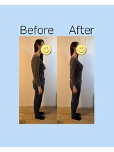 ヨスガ(YoSuGa)/姿勢矯正ビフォーアフター