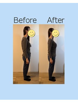 ヨスガ(YoSuGa)/姿勢矯正ビフォーアフター