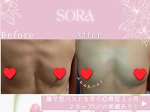ソラ(SORA)