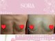 ソラ(SORA)の写真