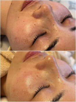 ミラビューティー(Mira Beauty)の写真/最近なんだか肌が変わってきた…大人肌に欲しかったハリ・ツヤを