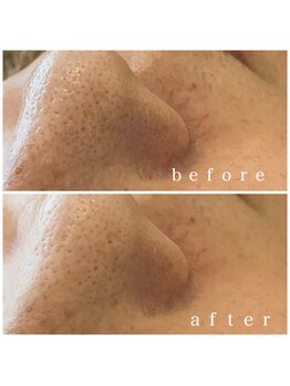 メナードフェイシャルサロン 岐阜茜部/しわたるみ/エイジングケア