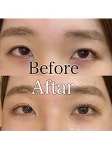 ルー(Lou)/ラッシュリフト